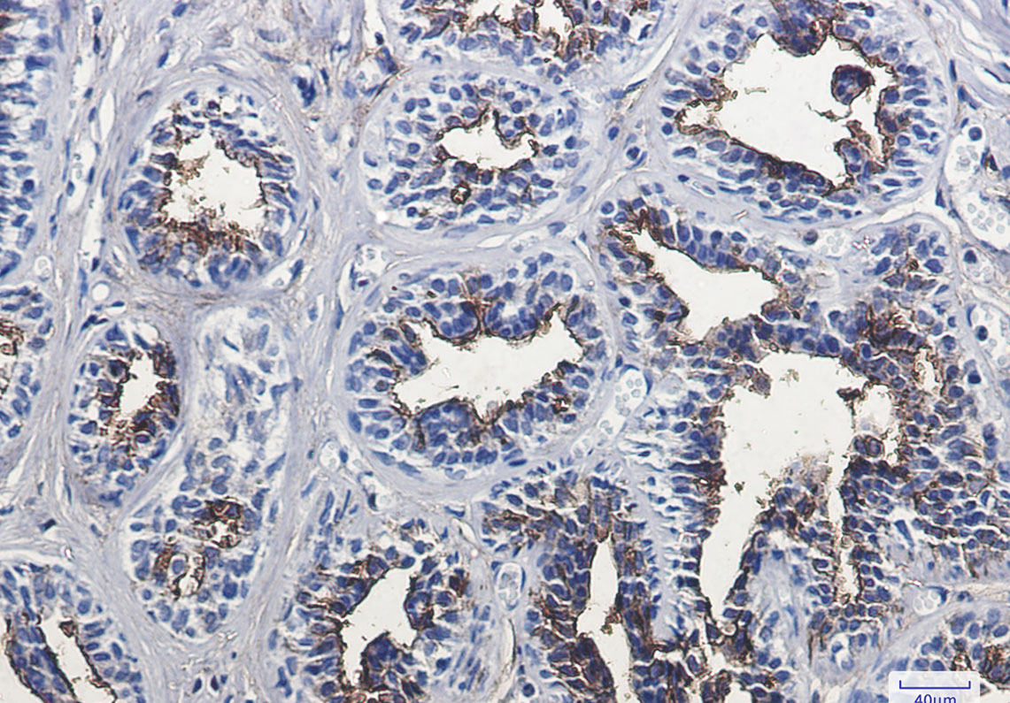 CD13 Rabbit mAb