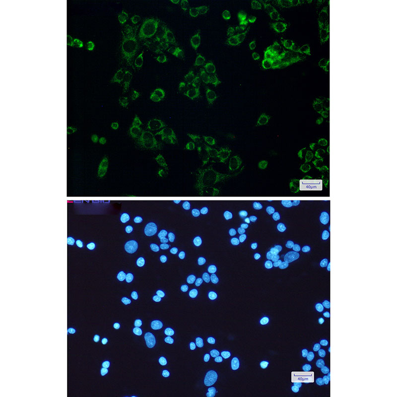 SLP2 Rabbit mAb