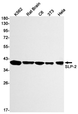 SLP2 Rabbit mAb