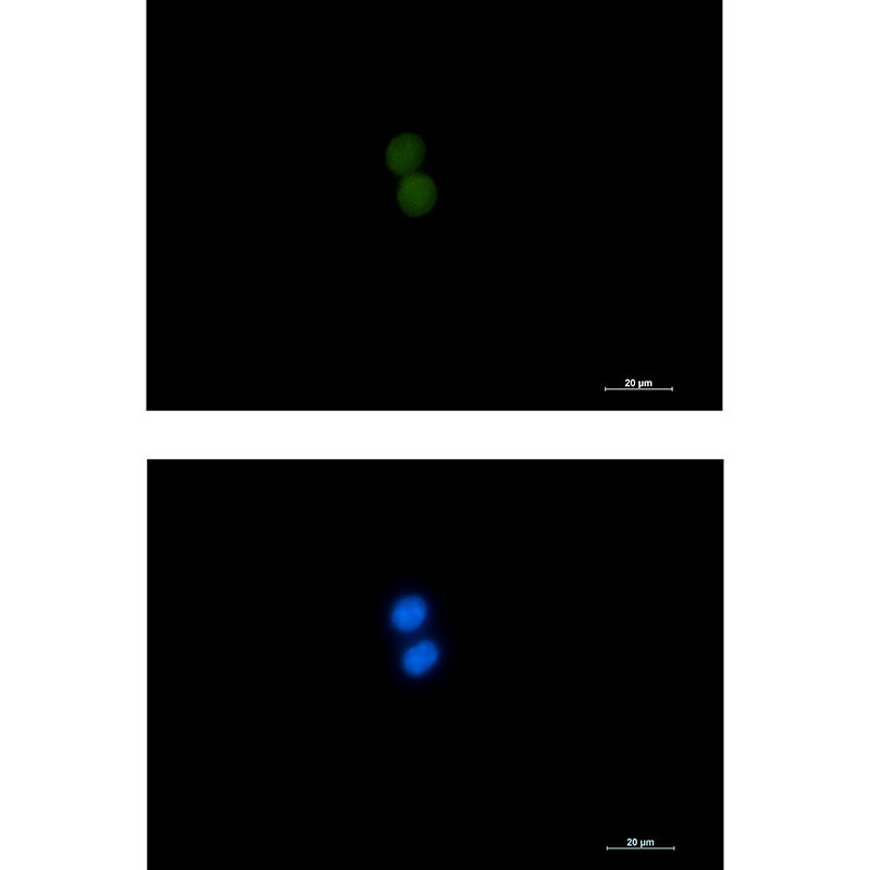 ASH2L Rabbit mAb