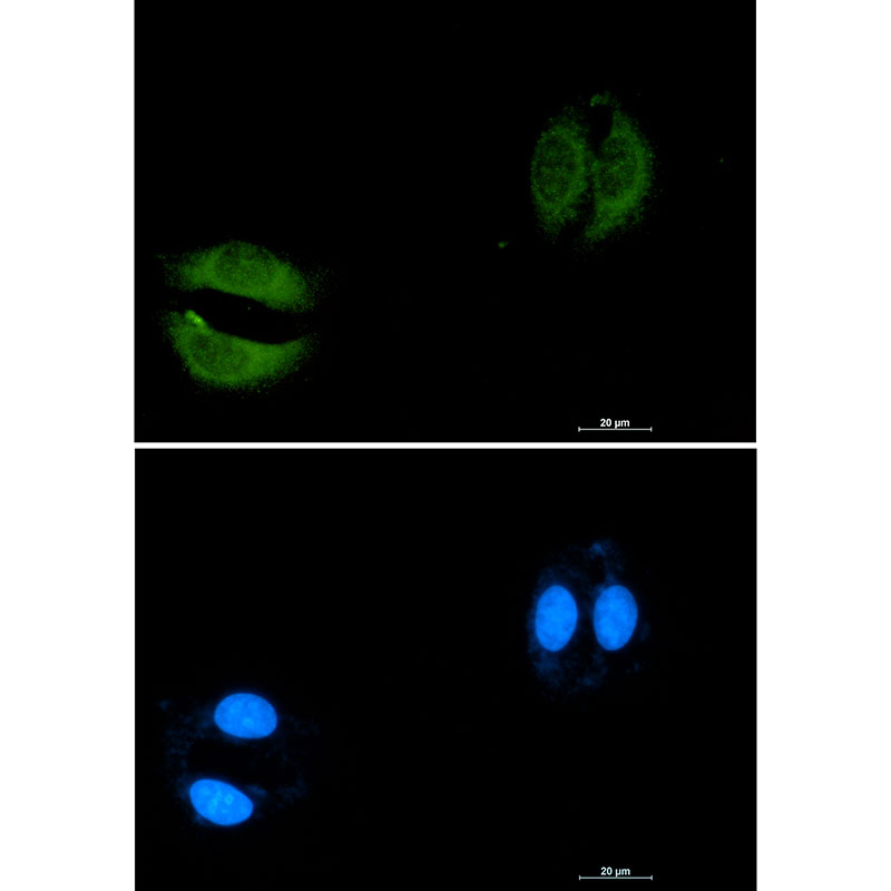 Rab5C Rabbit mAb