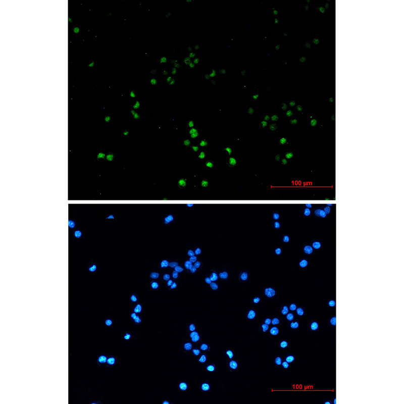 ZHX2 Rabbit mAb