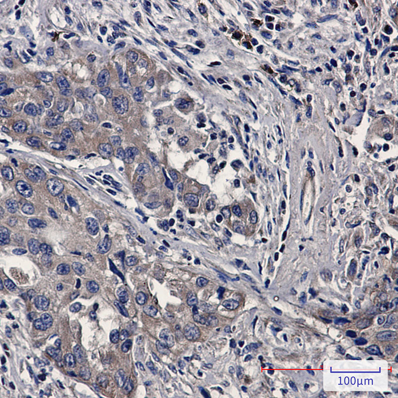 Bax Rabbit mAb