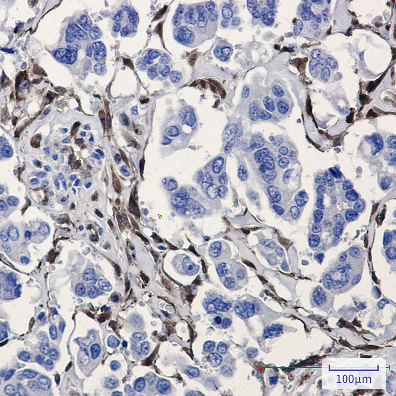 ALDH1A1 Rabbit mAb