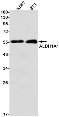 ALDH1A1 Rabbit mAb