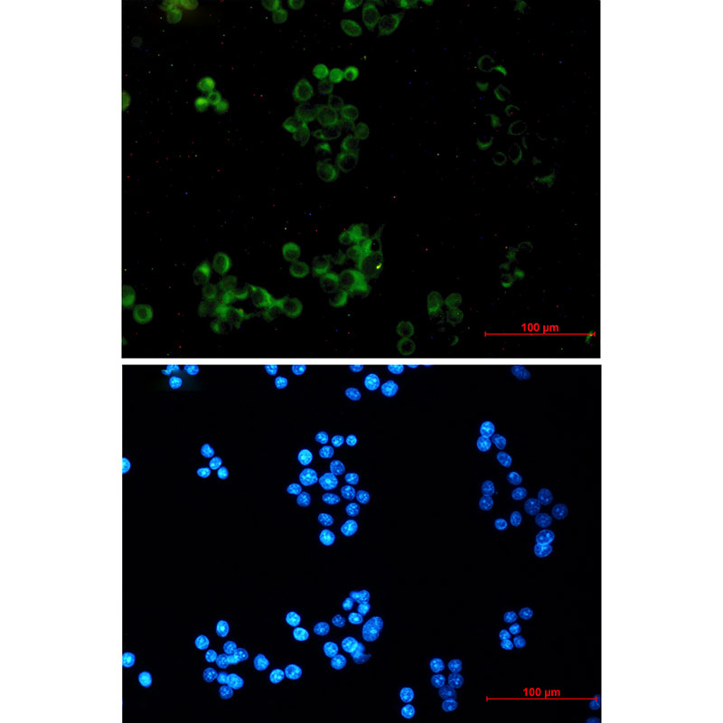 Amyloid Precursor Protein Rabbit mAb