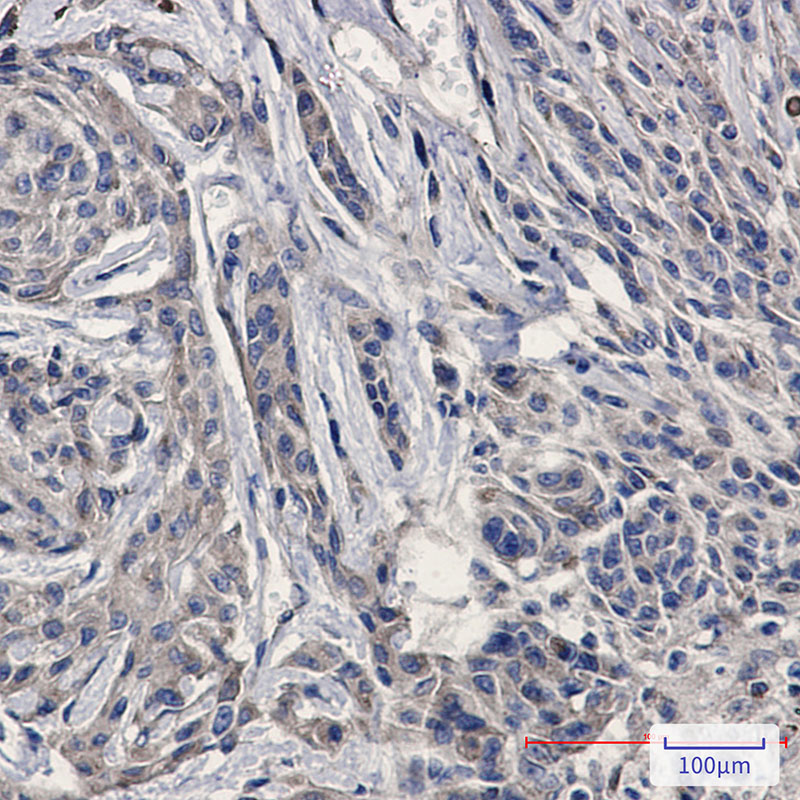 Amyloid Precursor Protein Rabbit mAb