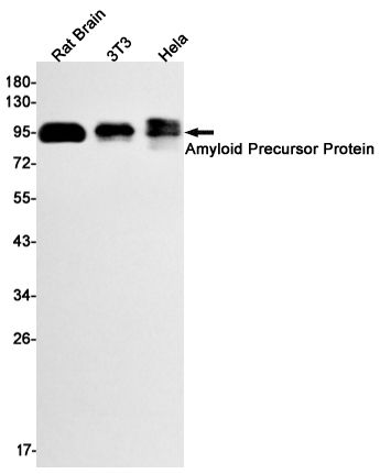 Amyloid Precursor Protein Rabbit mAb