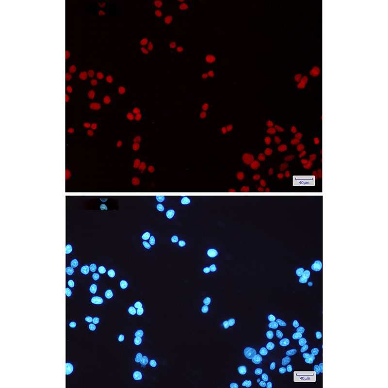 MSH6 Rabbit mAb