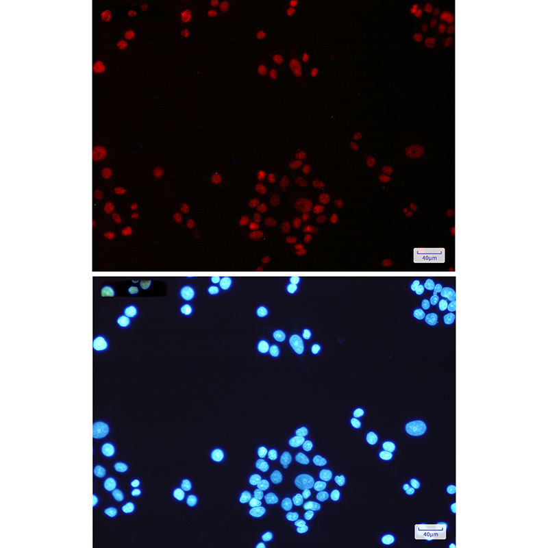 MLH1 Rabbit mAb