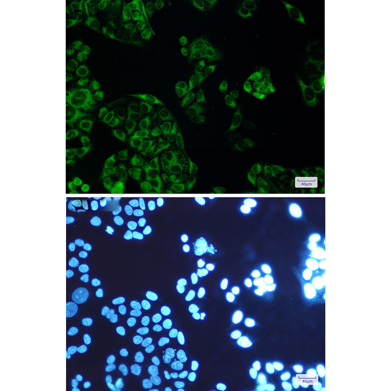 FDFT1 Rabbit mAb