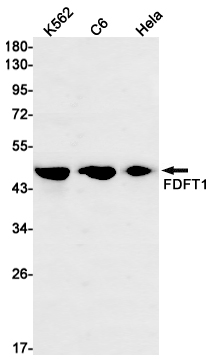 FDFT1 Rabbit mAb