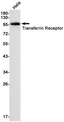 Transferrin Receptor 1 Rabbit mAb