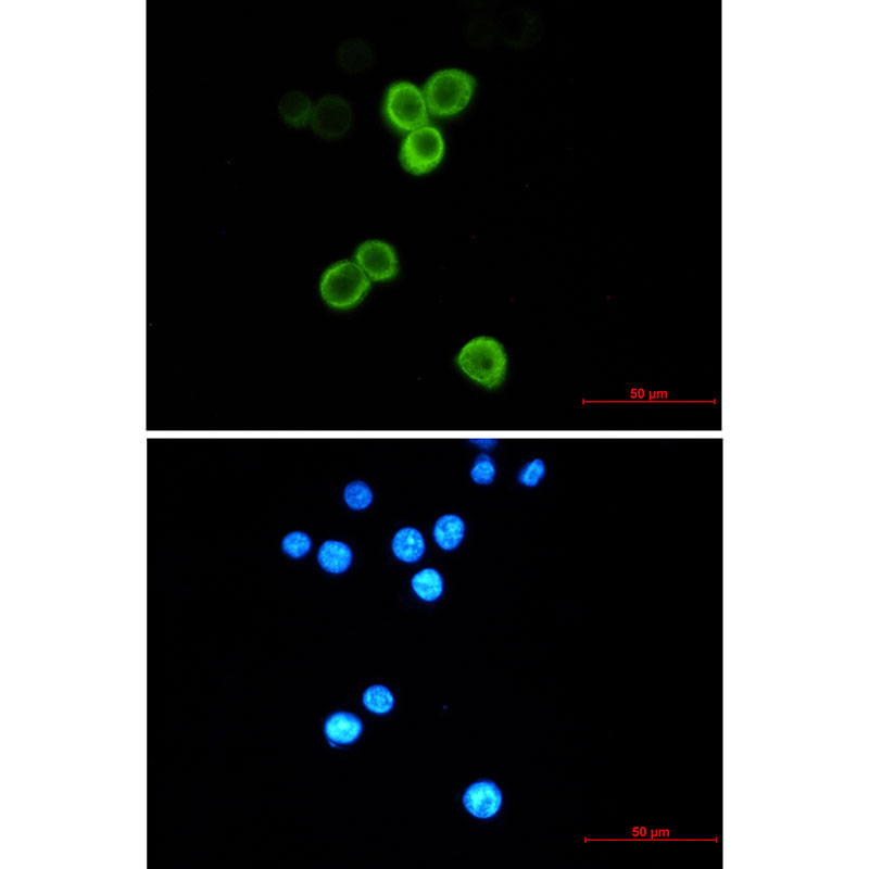 Anterior Gradient 2 Rabbit mAb