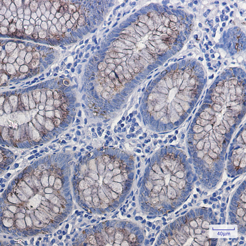 Anterior Gradient 2 Rabbit mAb