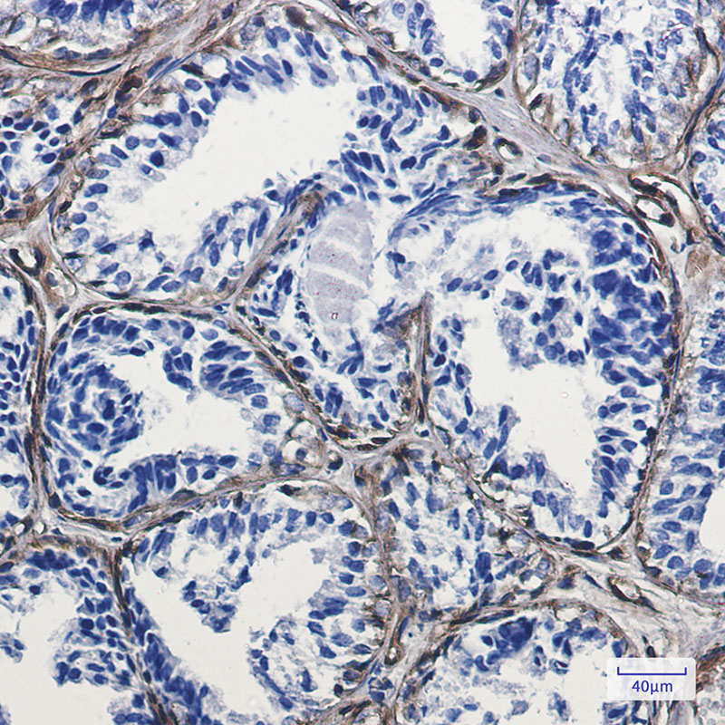 Caveolin 1 Rabbit mAb