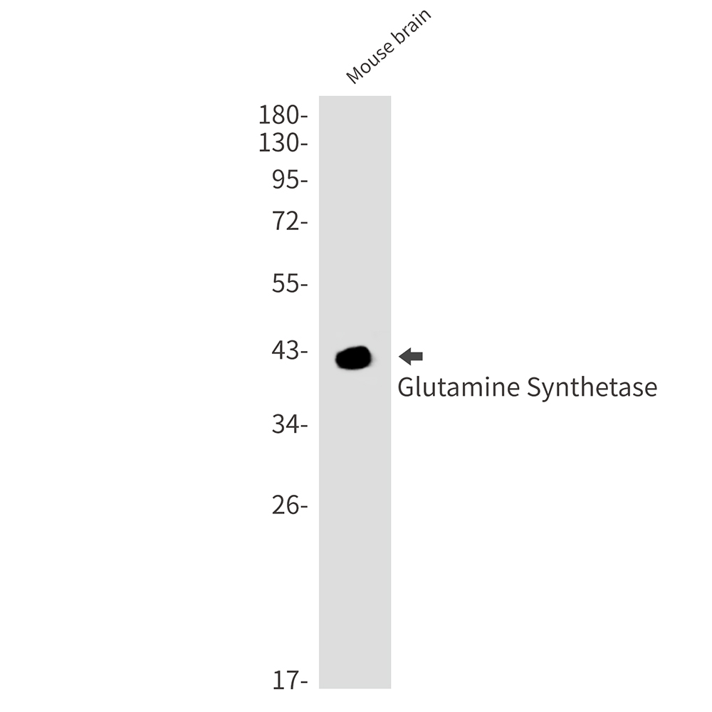 Glutamine Synthetase Rabbit mAb