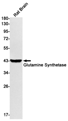 Glutamine Synthetase Rabbit mAb