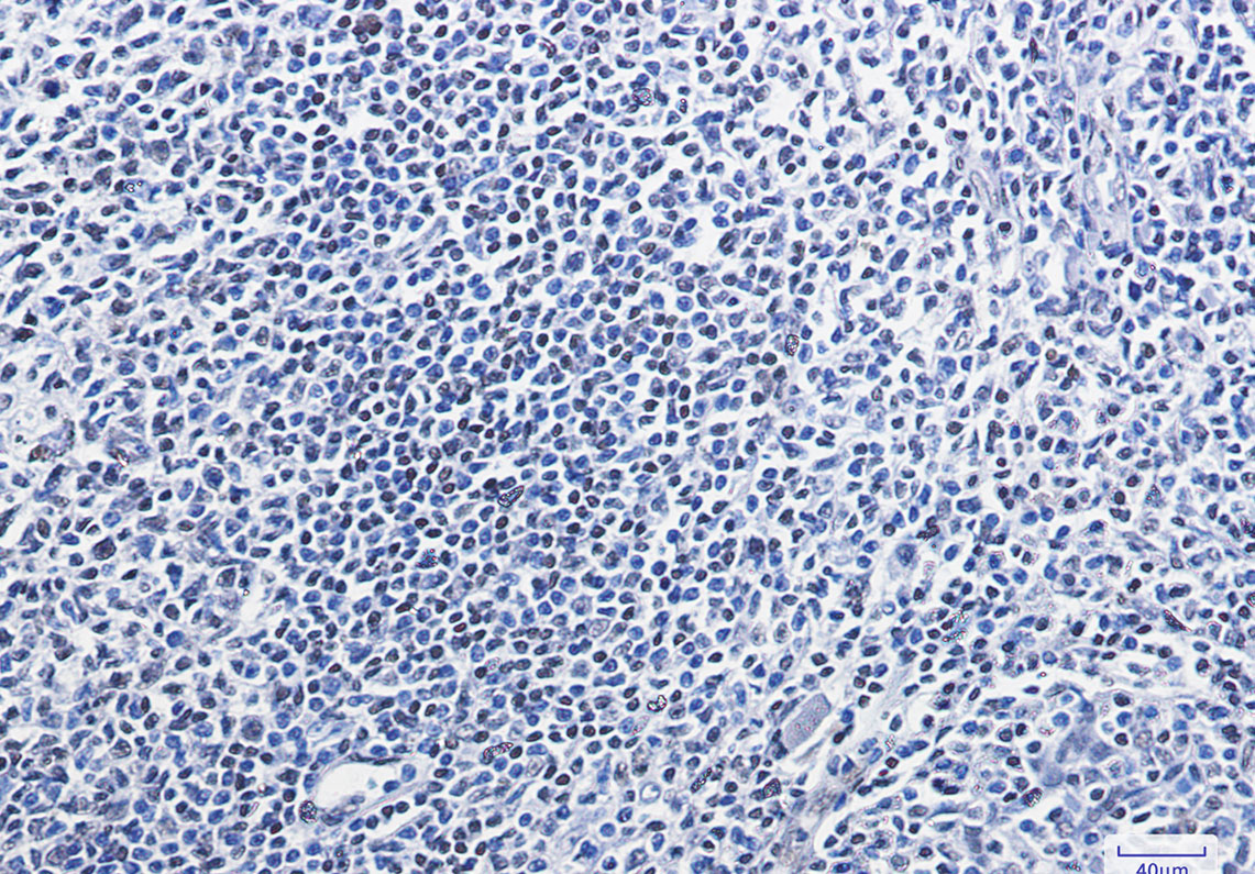 HMGB1 Rabbit mAb