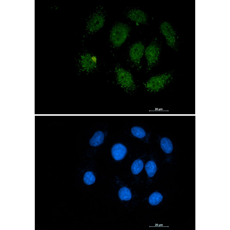 Smad3 Rabbit mAb