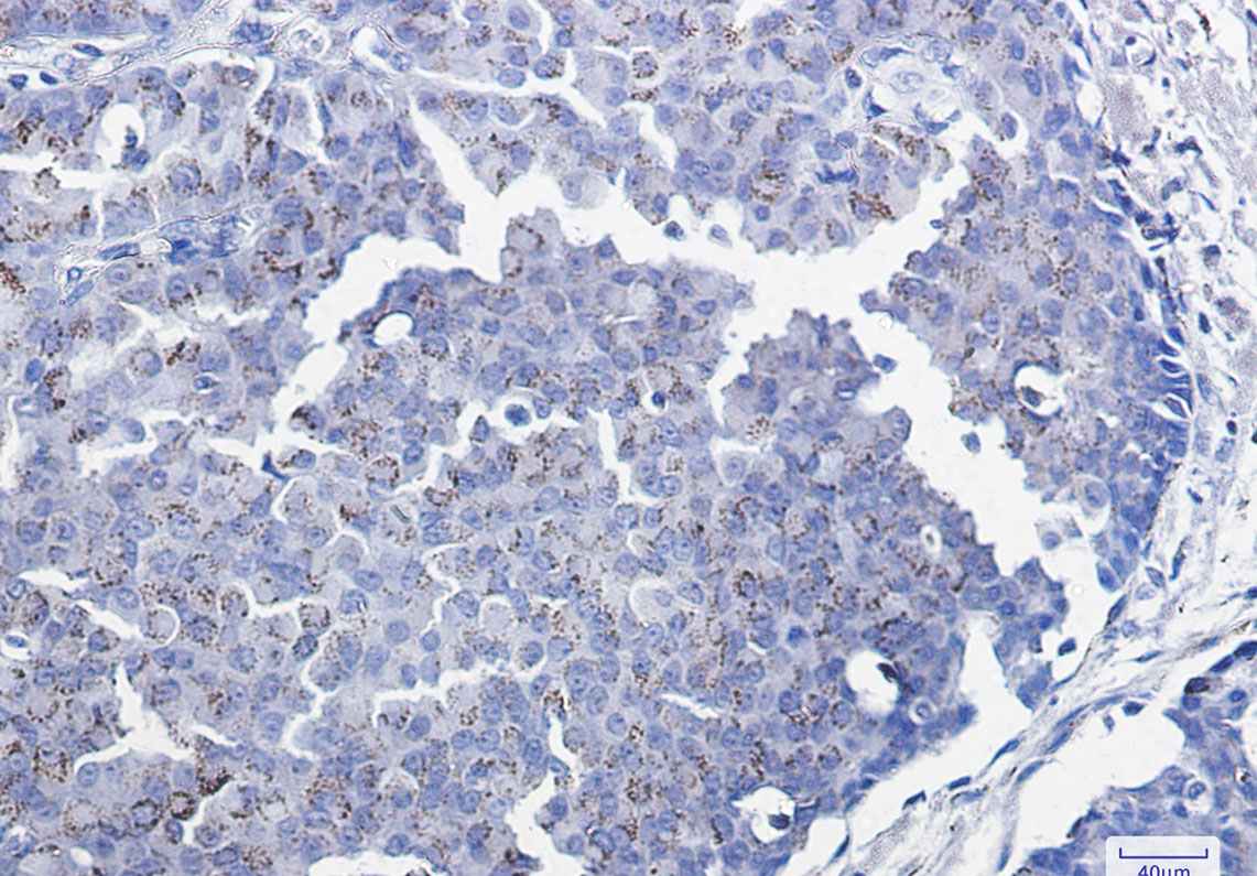 Smad3 Rabbit mAb