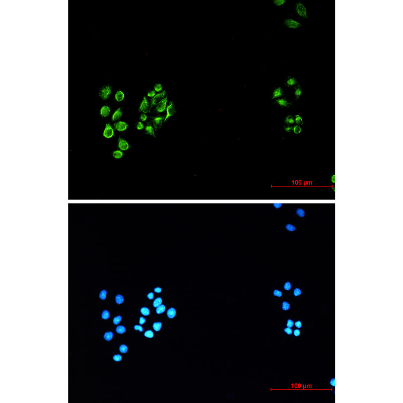 Vimentin Rabbit mAb