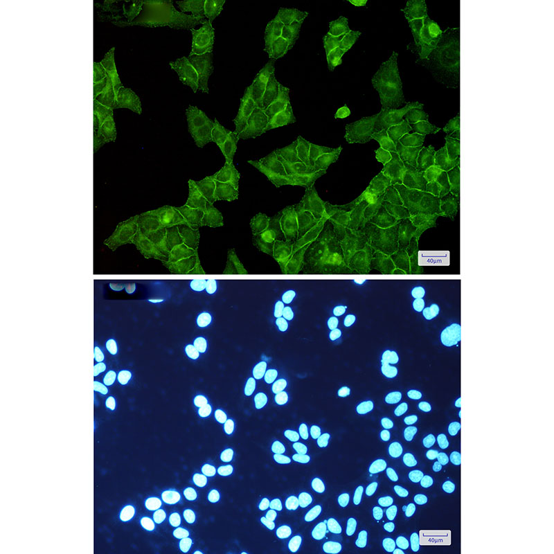 EGFR Rabbit mAb