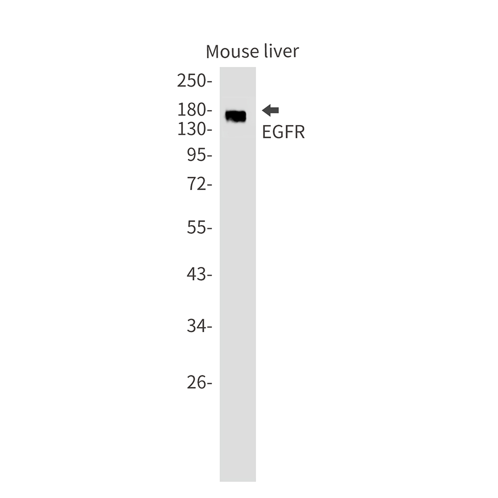 EGFR Rabbit mAb