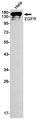 EGFR Rabbit mAb