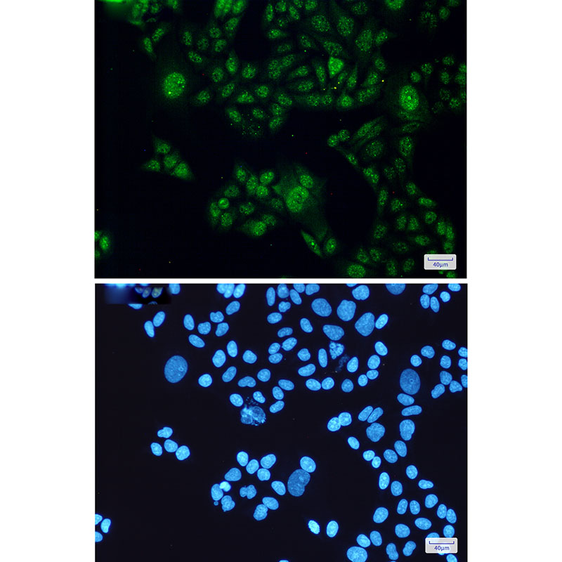 STAT3 Rabbit mAb