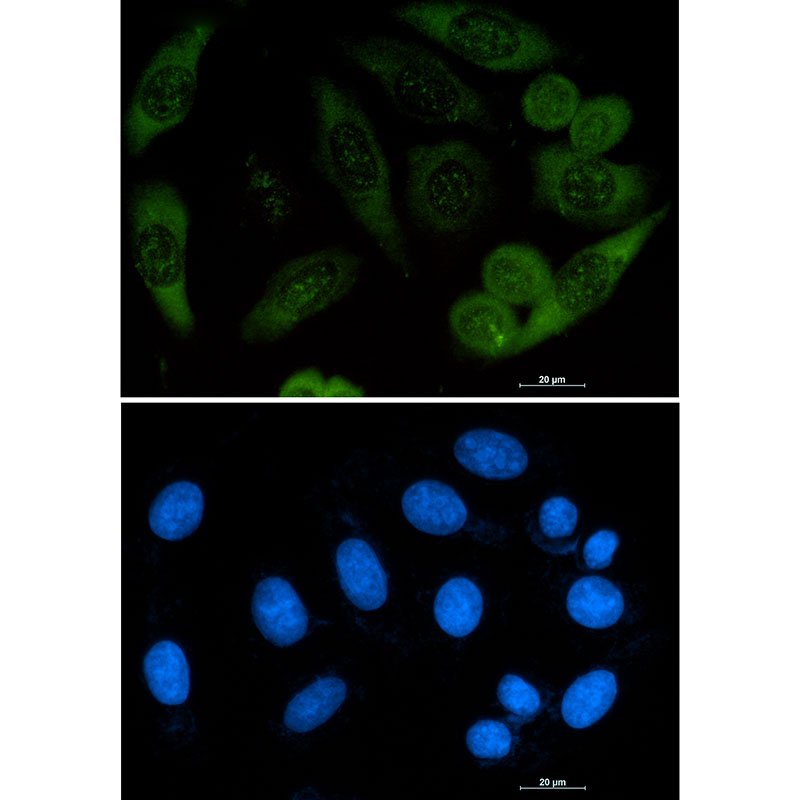 Profilin 1 Rabbit mAb