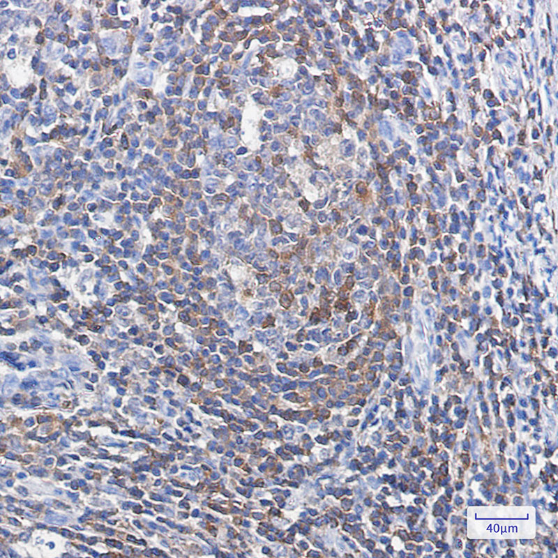 Profilin 1 Rabbit mAb