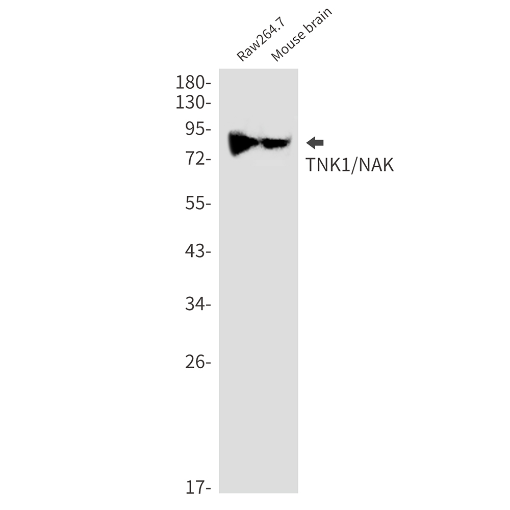 TBK1 Rabbit mAb