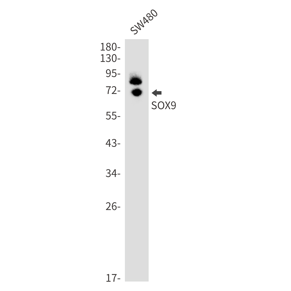 SOX9 Rabbit mAb