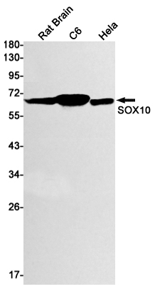 SOX10 Rabbit mAb