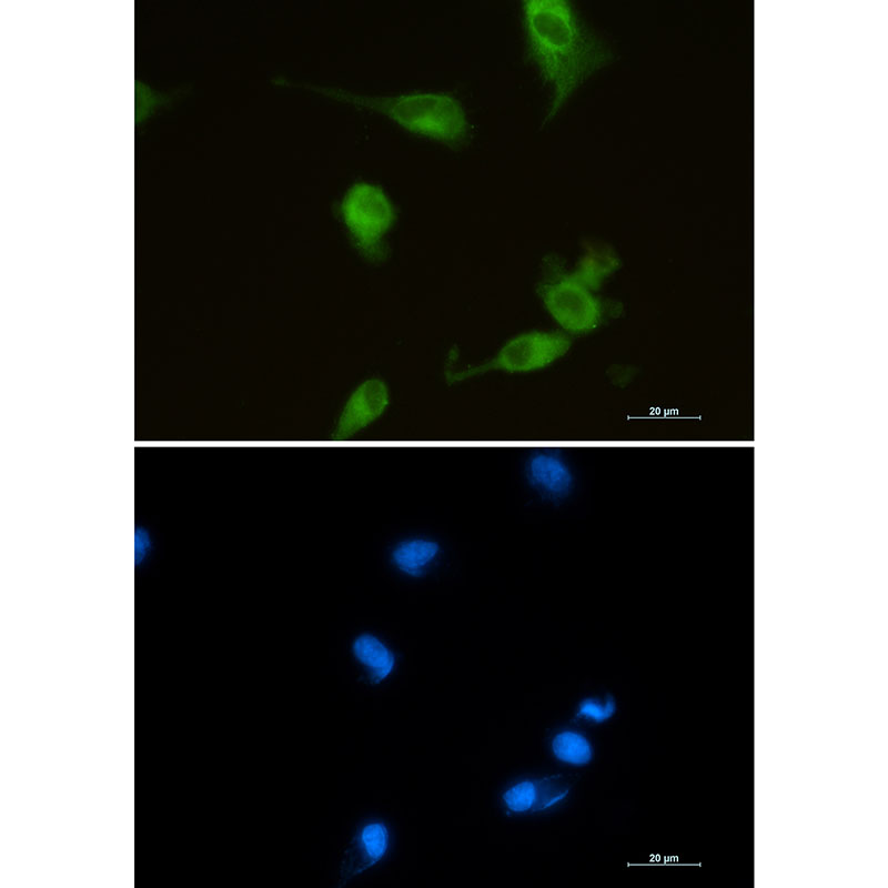 Heme Oxygenase 1 Rabbit mAb