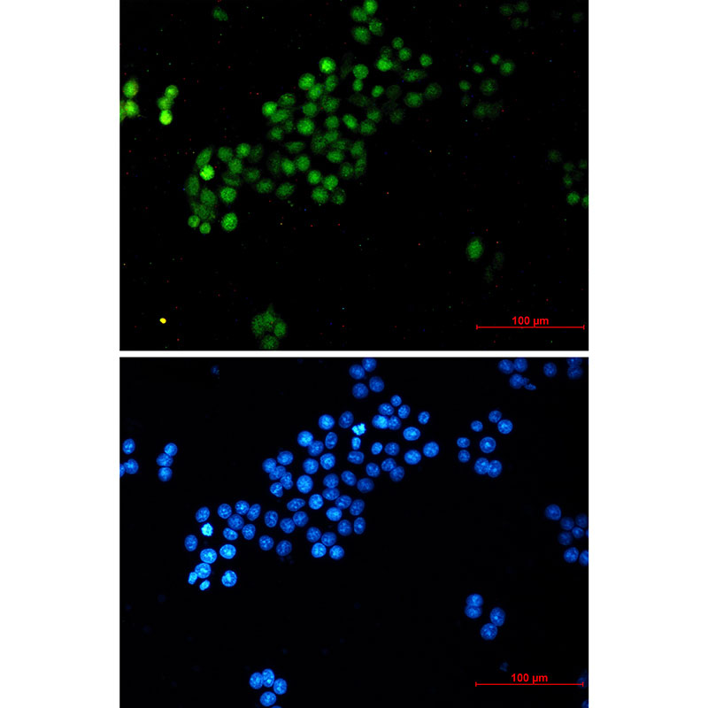 c-Myc Rabbit mAb