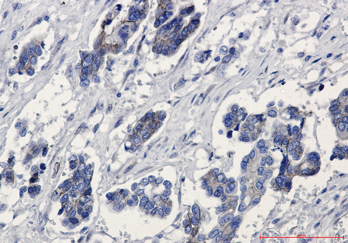 beta Catenin Rabbit mAb