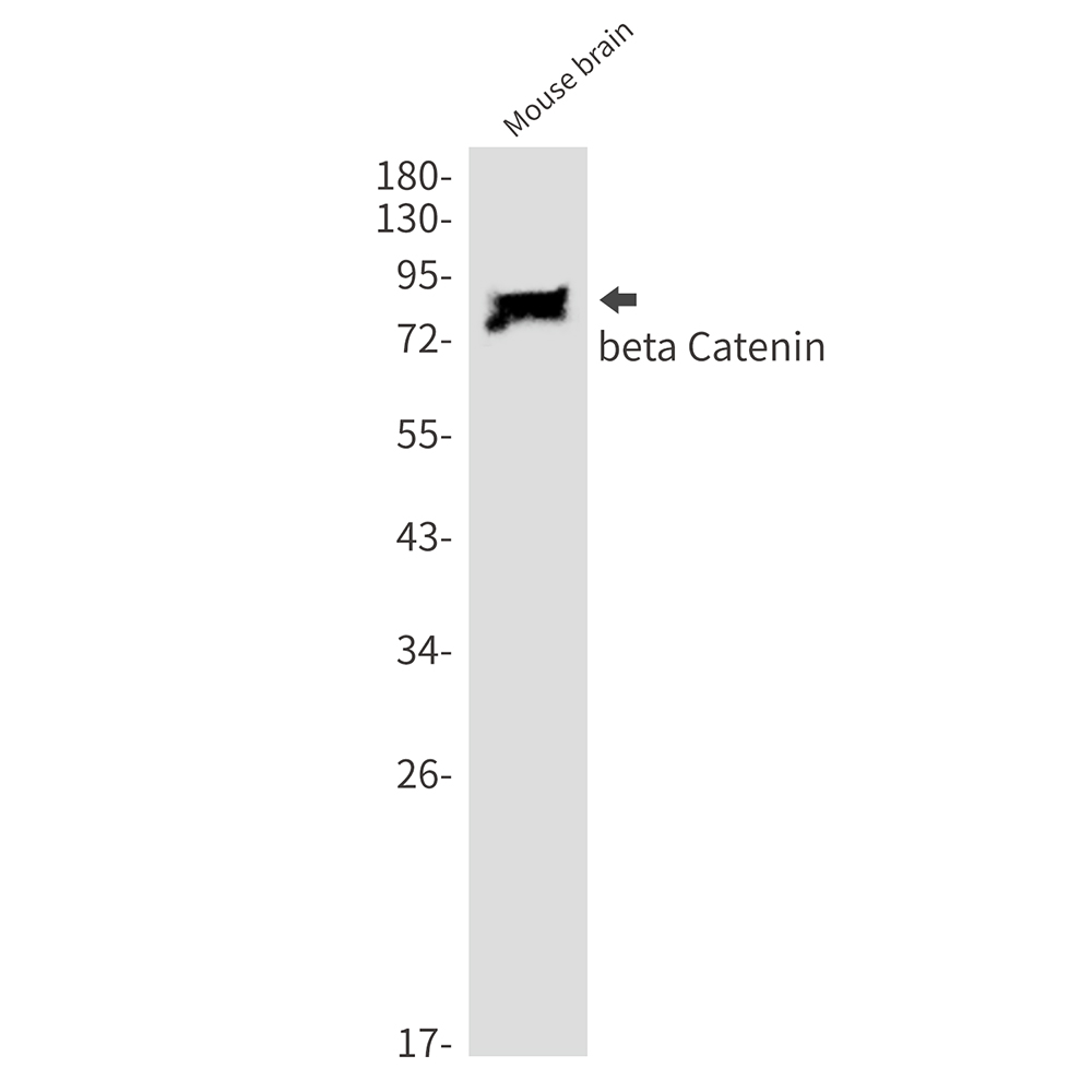 beta Catenin Rabbit mAb