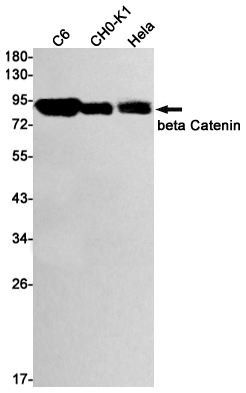 beta Catenin Rabbit mAb