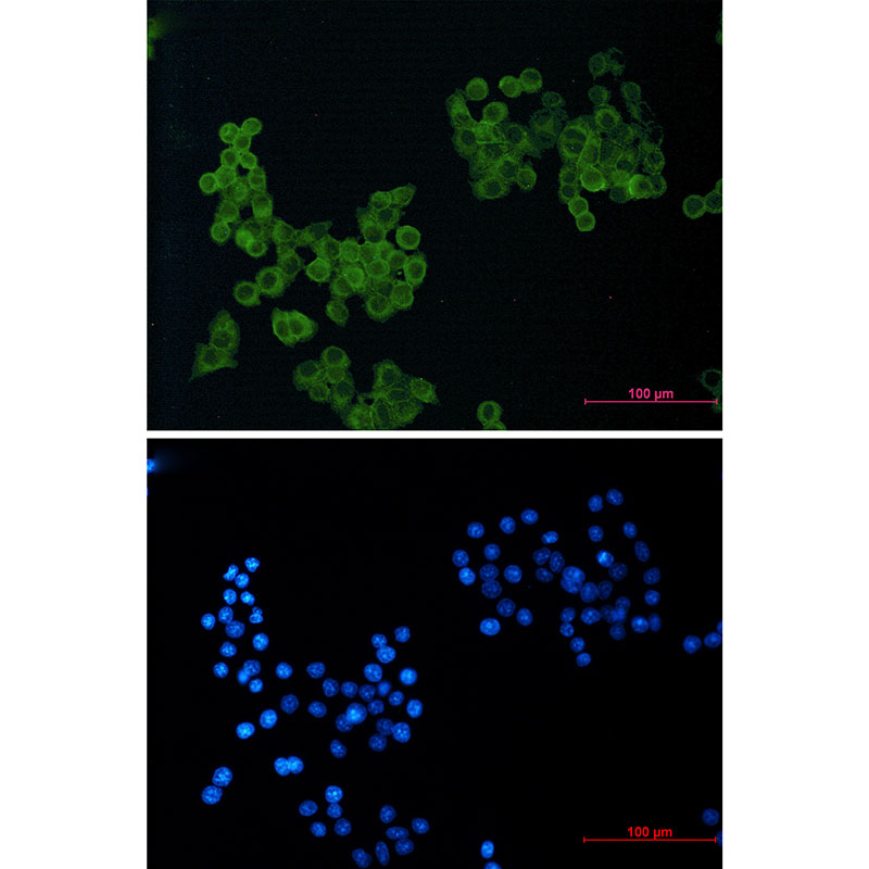 CD146 Rabbit mAb