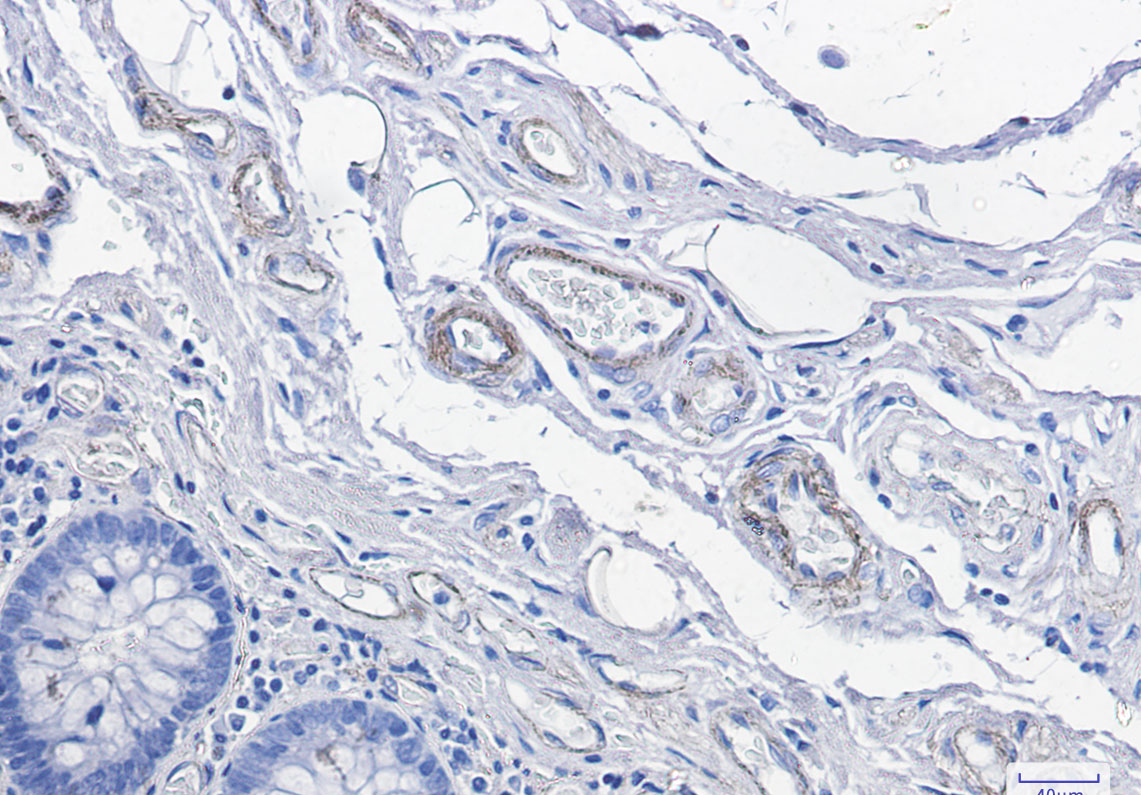 CD146 Rabbit mAb