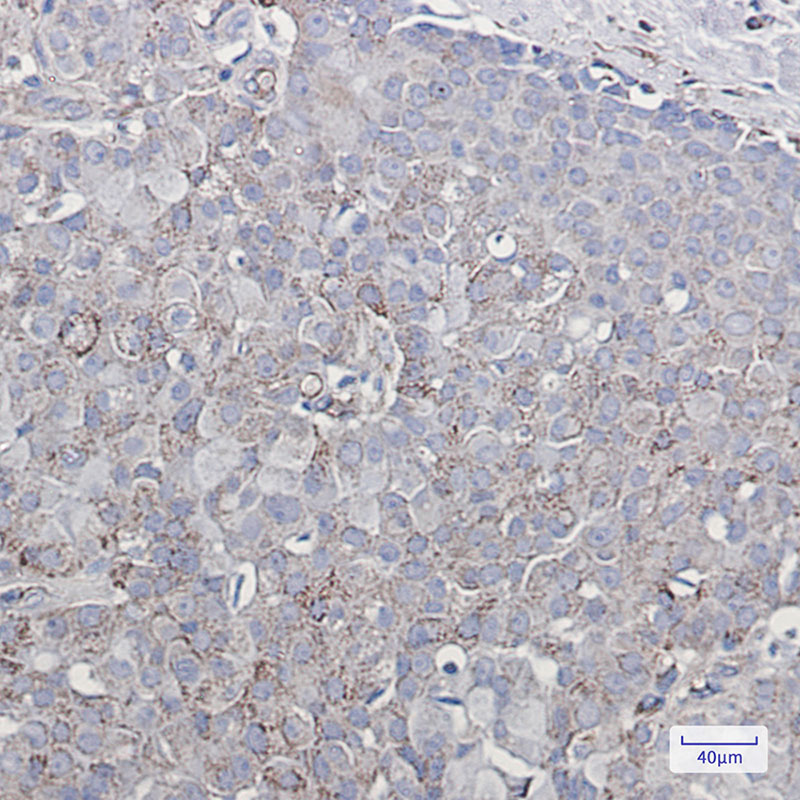 Ionotropic Glutamate Receptor 2 Rabbit mAb