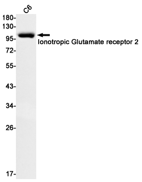 Ionotropic Glutamate Receptor 2 Rabbit mAb