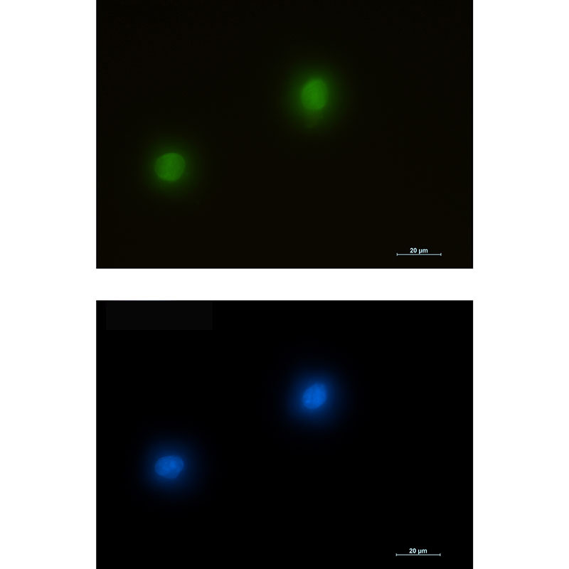 ERK2 Rabbit mAb