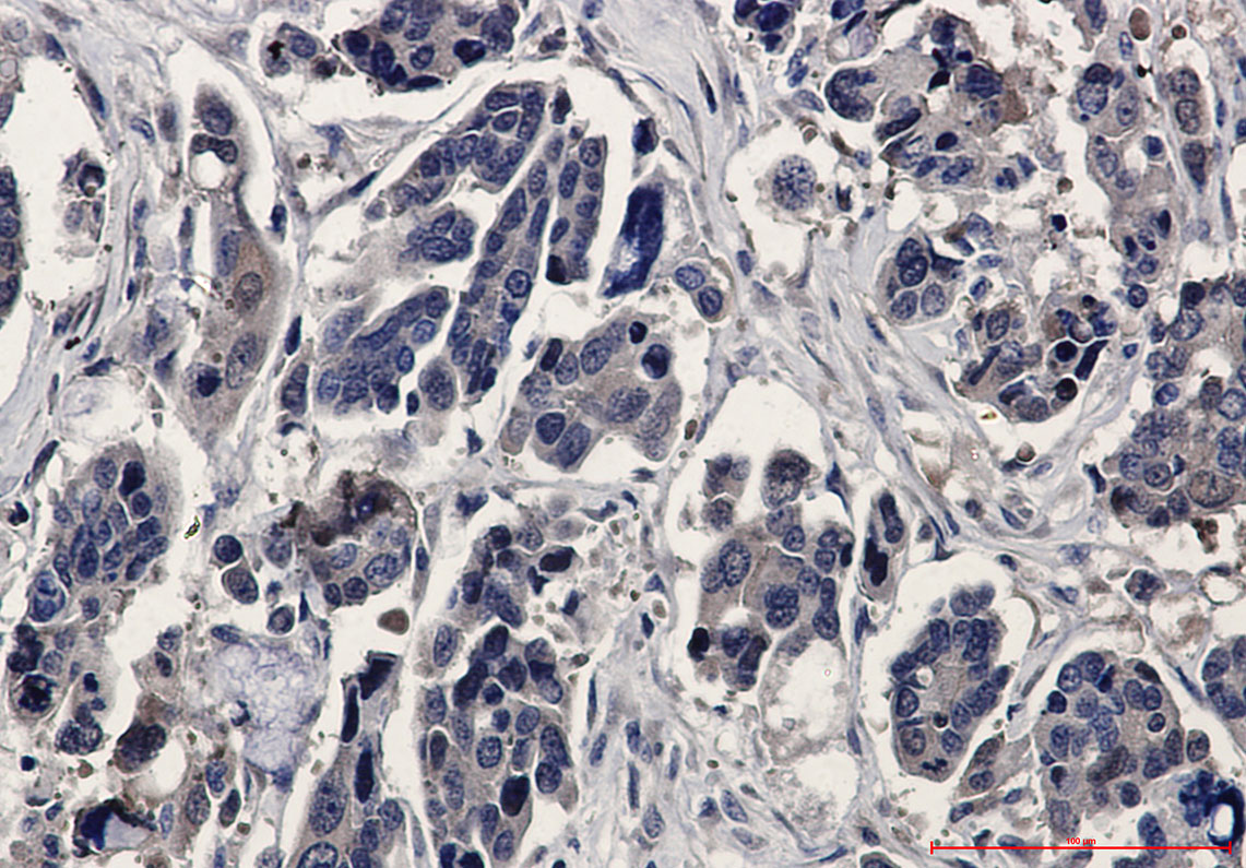 ERK2 Rabbit mAb