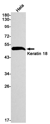 Cytokeratin 18 Rabbit mAb