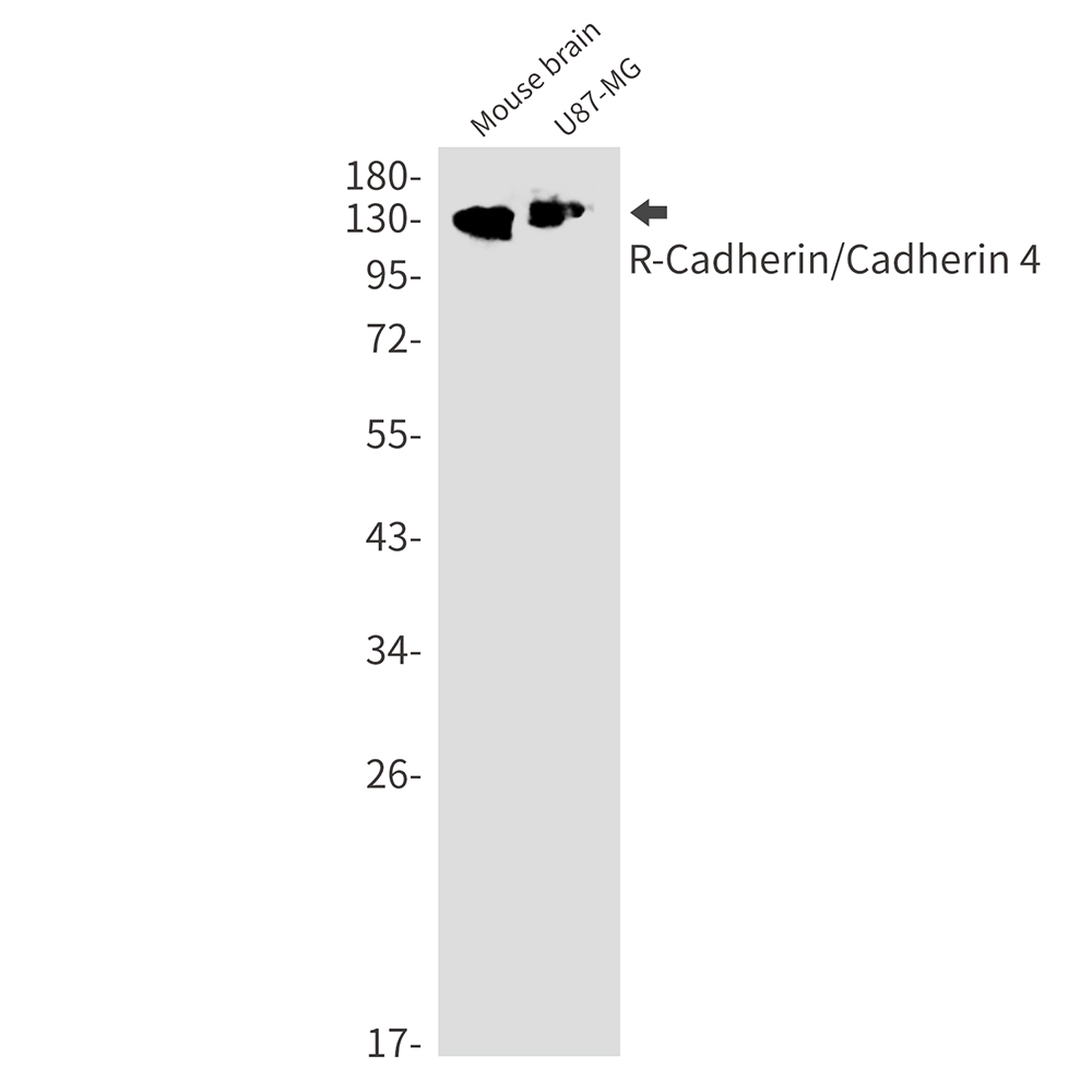 R Cadherin Rabbit mAb