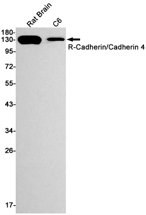 R Cadherin Rabbit mAb