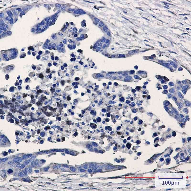 GSK3 beta Rabbit mAb